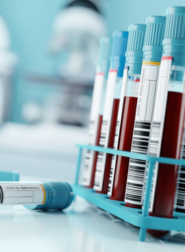 Blood Test Results In A Medical Lab